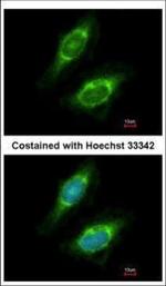 CKAP4 Polyclonal Antibody