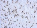 CKAP4 Antibody in Immunohistochemistry (Paraffin) (IHC (P))