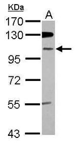 ZNF512B Antibody in Western Blot (WB)