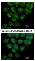 DYNC1LI1 Polyclonal Antibody