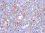 ASAP3 Polyclonal Antibody