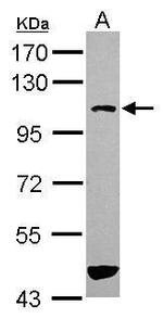 ASAP3 Antibody in Western Blot (WB)