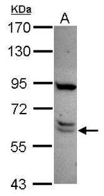 CWF19L1 Antibody in Western Blot (WB)