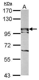 BOP1 Polyclonal Antibody