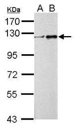 ZNF711 Polyclonal Antibody