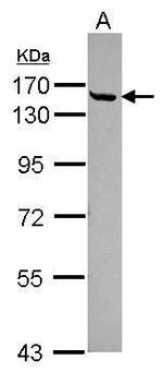 CGN Antibody in Western Blot (WB)