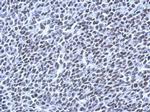 RSRP1 Antibody in Immunohistochemistry (Paraffin) (IHC (P))