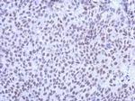 KLHL13 Polyclonal Antibody