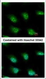 KIAA0323 Polyclonal Antibody