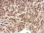 KIAA0323 Antibody in Immunohistochemistry (Paraffin) (IHC (P))