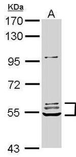 SNX27 Antibody in Western Blot (WB)