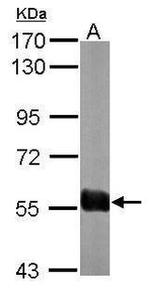 SNX27 Antibody in Western Blot (WB)