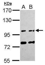 FAM171A1 Antibody in Western Blot (WB)