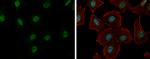 RBM26 Polyclonal Antibody
