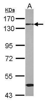 RBM26 Antibody in Western Blot (WB)