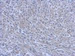 FCHO1 Polyclonal Antibody