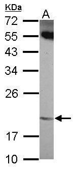 ANKRD39 Polyclonal Antibody