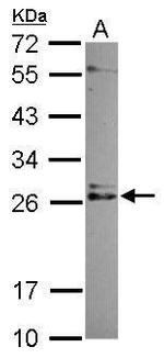 IMP3 Polyclonal Antibody