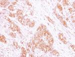 RAB35 Antibody in Immunohistochemistry (Paraffin) (IHC (P))