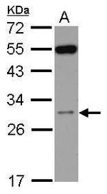 RPS8 Polyclonal Antibody