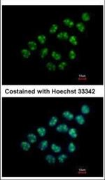 Nop25 Polyclonal Antibody