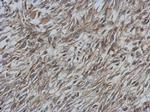 CCDC70 Antibody in Immunohistochemistry (Paraffin) (IHC (P))