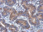 CCDC70 Polyclonal Antibody