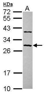 CCDC70 Antibody in Western Blot (WB)