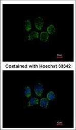 TPGS2 Polyclonal Antibody