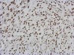 RASSF4 Antibody in Immunohistochemistry (Paraffin) (IHC (P))