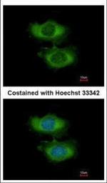 NAA16 Polyclonal Antibody