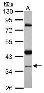 CCDC94 Polyclonal Antibody