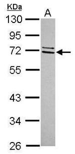 CCDC67 Polyclonal Antibody