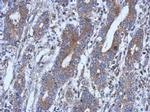 NSUN4 Polyclonal Antibody