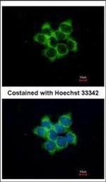 FUZ Polyclonal Antibody