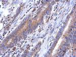 LYPLA3 Antibody in Immunohistochemistry (Paraffin) (IHC (P))