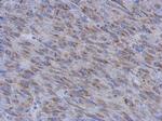 MUM1L1 Polyclonal Antibody