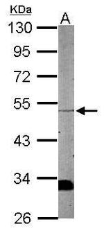 WDR12 Antibody in Western Blot (WB)
