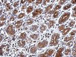 PSG3 Polyclonal Antibody