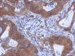 WDR85 Polyclonal Antibody