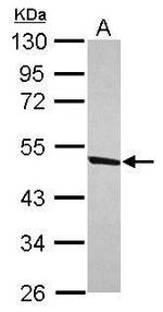 DDX47 Antibody in Western Blot (WB)