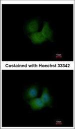 FBXL16 Polyclonal Antibody