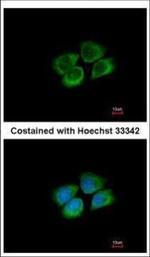 PARS2 Polyclonal Antibody