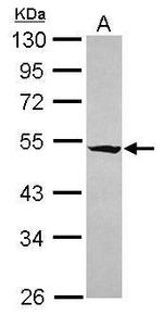 RASGEF1A Antibody in Western Blot (WB)