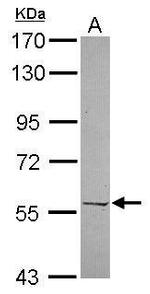 PRPF4 Polyclonal Antibody