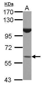 BTBD16 Polyclonal Antibody