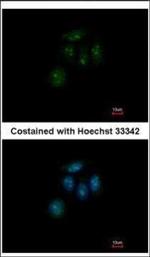 ZFP69 Polyclonal Antibody