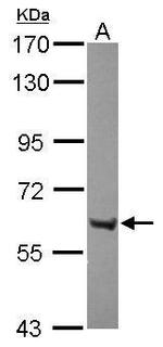 ZFP69 Antibody in Western Blot (WB)