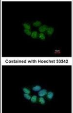 PHACTR3 Antibody in Immunocytochemistry (ICC/IF)