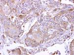 PYROXD2 Polyclonal Antibody